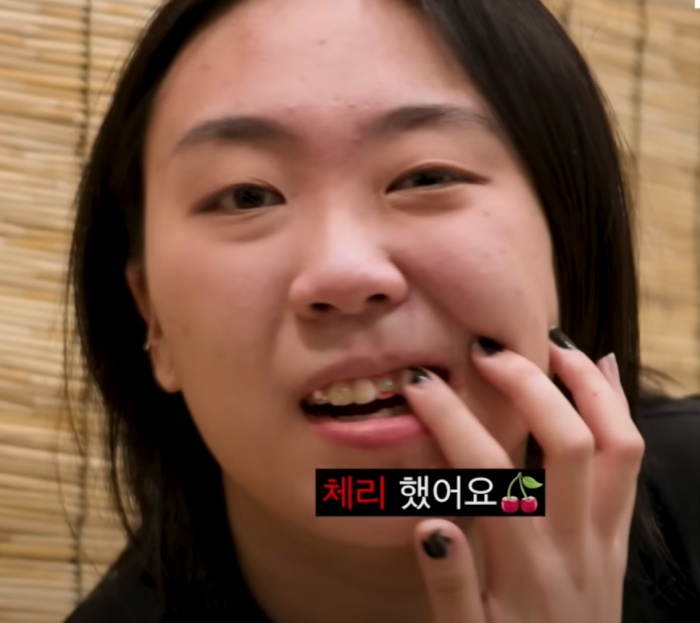 이영지투스젬, 리사투스젬 뜻? 시술 과정과 부작용 관련 이미지 2