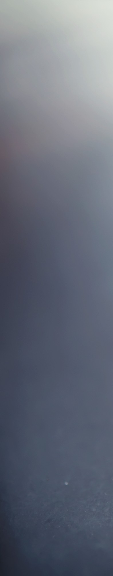 송곳니 덧니교정, 비발치로 안전하게 진행 관련 이미지 2