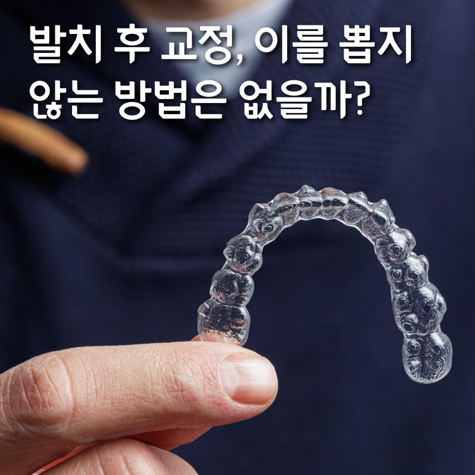 발치 후 교정, 이빨을 뽑지 않는 치료 방법이 있다? 관련 이미지 1