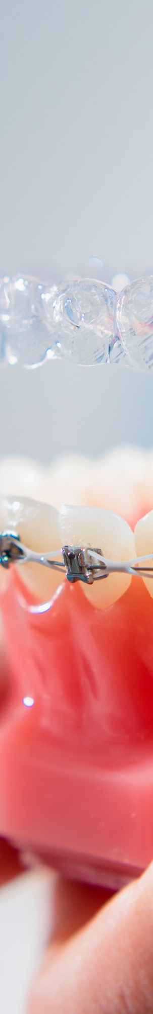 강남역치아교정, 비발치 치료, 구강 구조 개선, 맡길 수 있는 곳에! 관련 이미지 15