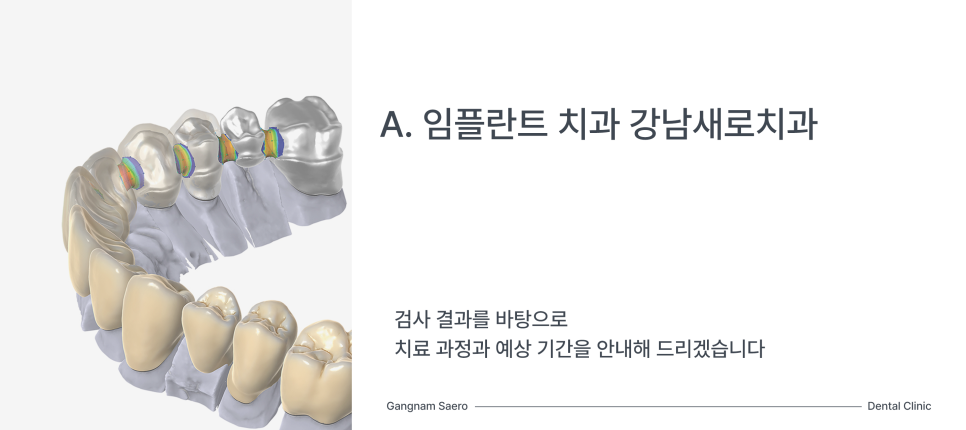 임플란트 구체적인 질문 MRI, 골다공증, 치아교정, 충치 Q&A 모음 관련 이미지 6