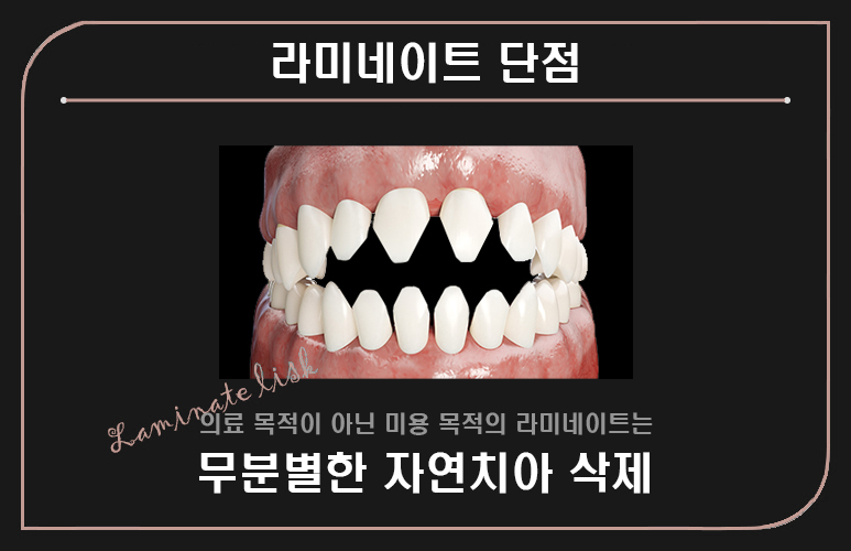 에어네이트의 예술성 (삭제 제로라미네이트) 관련 이미지 3