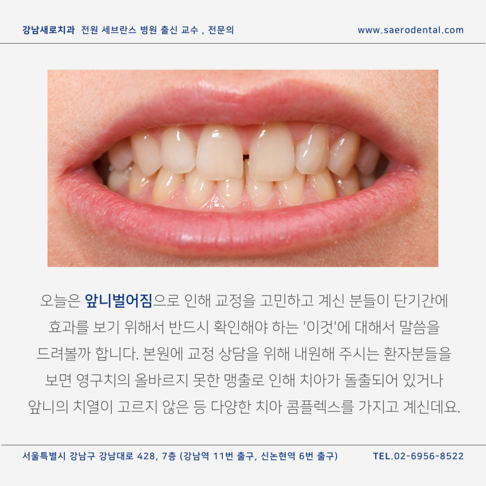 앞니벌어짐, 단기간에 효과 보시려면 관련 이미지 1