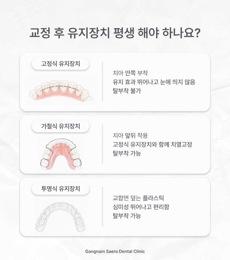 교정 후 유지장치 꼭 해야 할까요? (유지장치기간 유지기기간) 관련 이미지 5