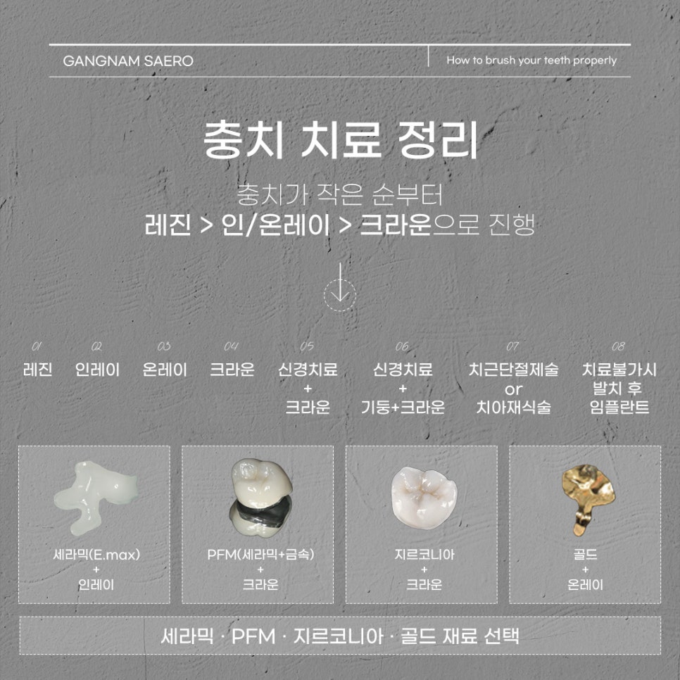 임플란트 수술 전 마지막으로 자연치아 살리기 (치근단절제술) 관련 이미지 3