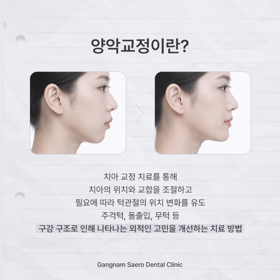 양악교정이란, 수술 없이 얼굴 변화를 만드는 방법 관련 이미지 2