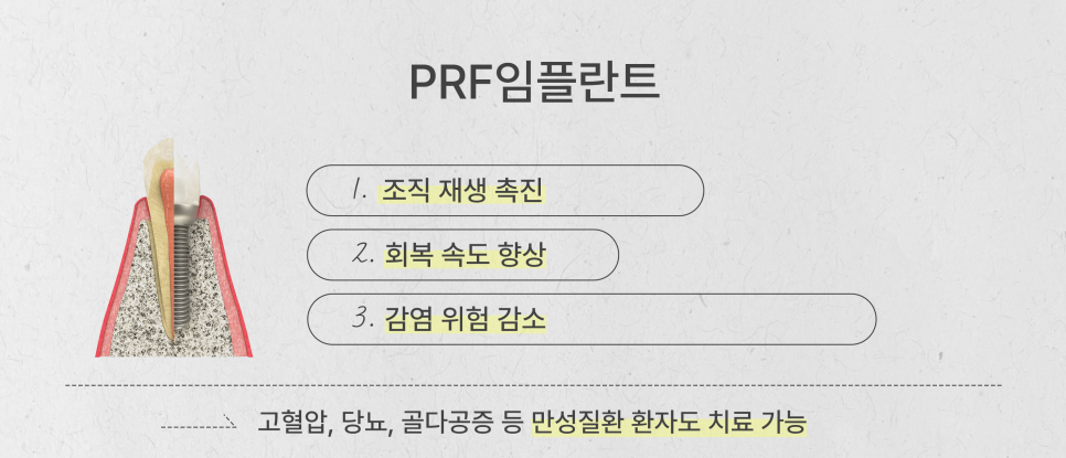 어머니 아버지를 위한 전체임플란트 최소 식립 (65세이상임플란트) 관련 이미지 3
