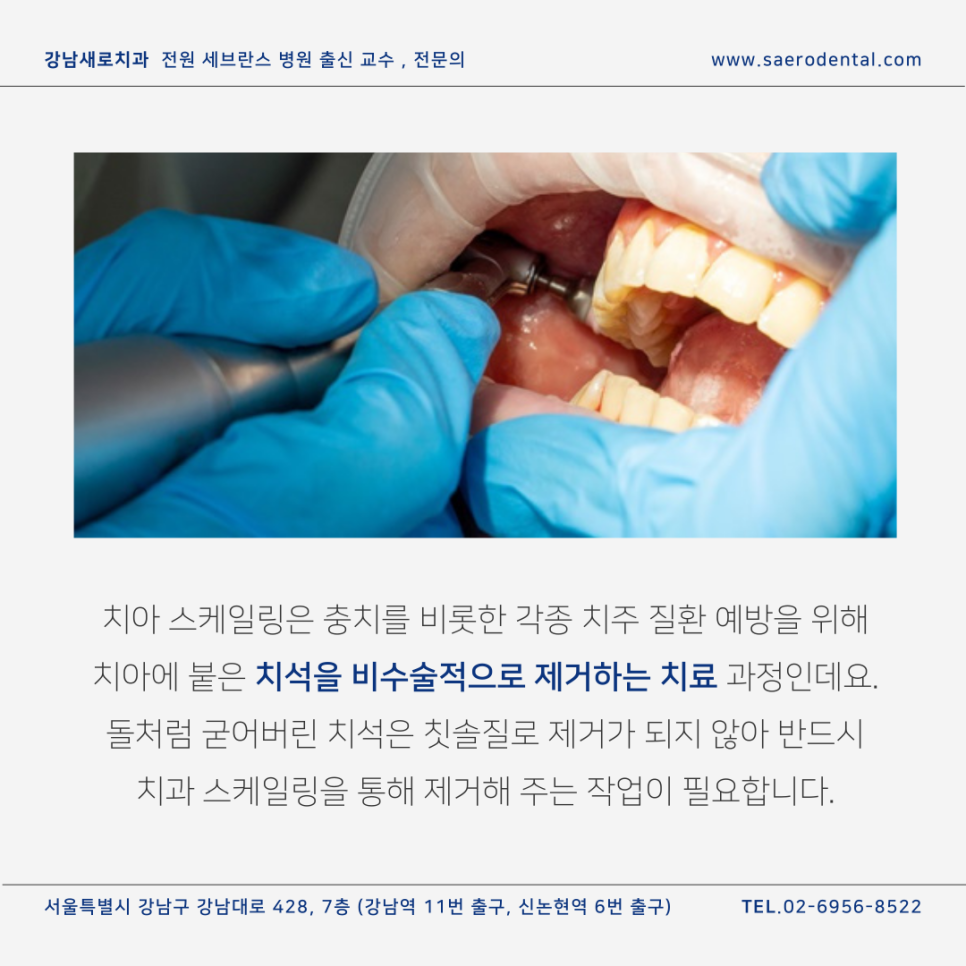 무통스케일링, 관련 이미지 2