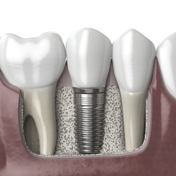 강남양심치과에서 문제 없이 진료를 진행하려면 관련 이미지 6