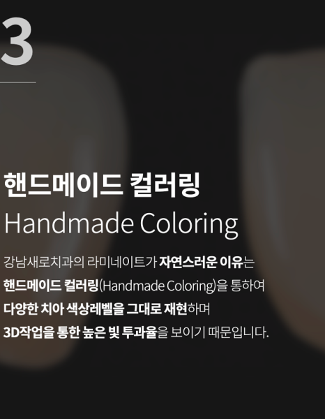 풍자 라미네이트? 치아 삭제 없는 과정으로 관련 이미지 8