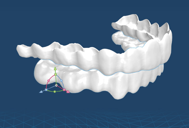투명교정종류 자세히 알아보기 (4) 세라핀 관련 이미지 5