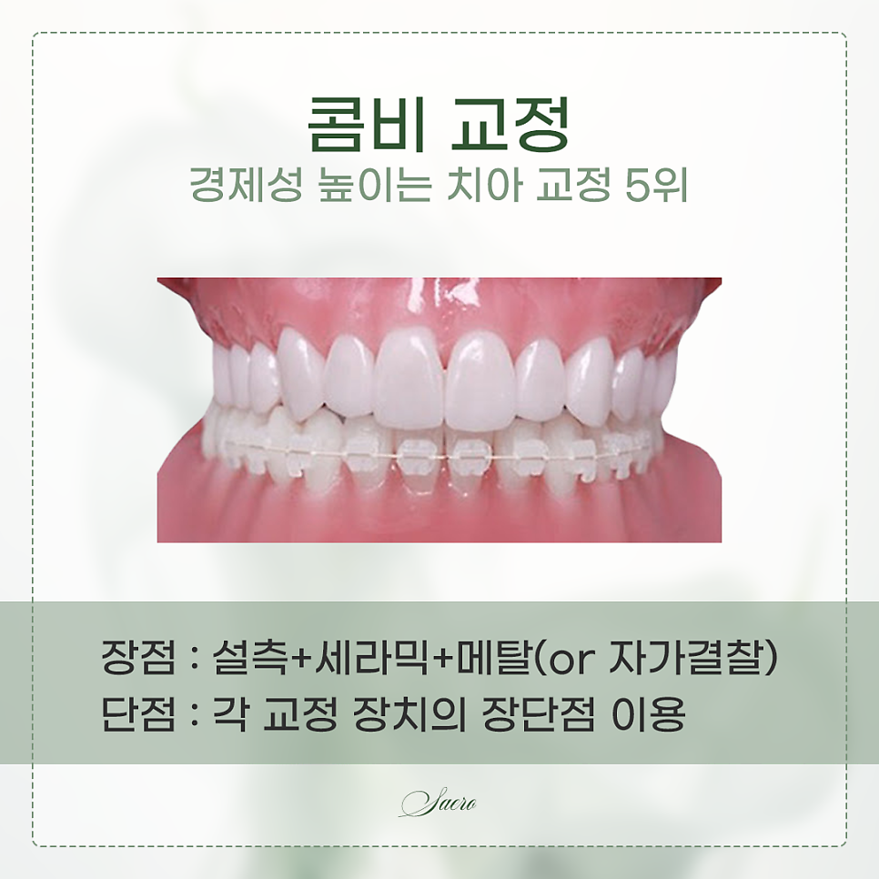 치아교정 가격이 어떻게 되나요? (치아교정비용) 관련 이미지 6