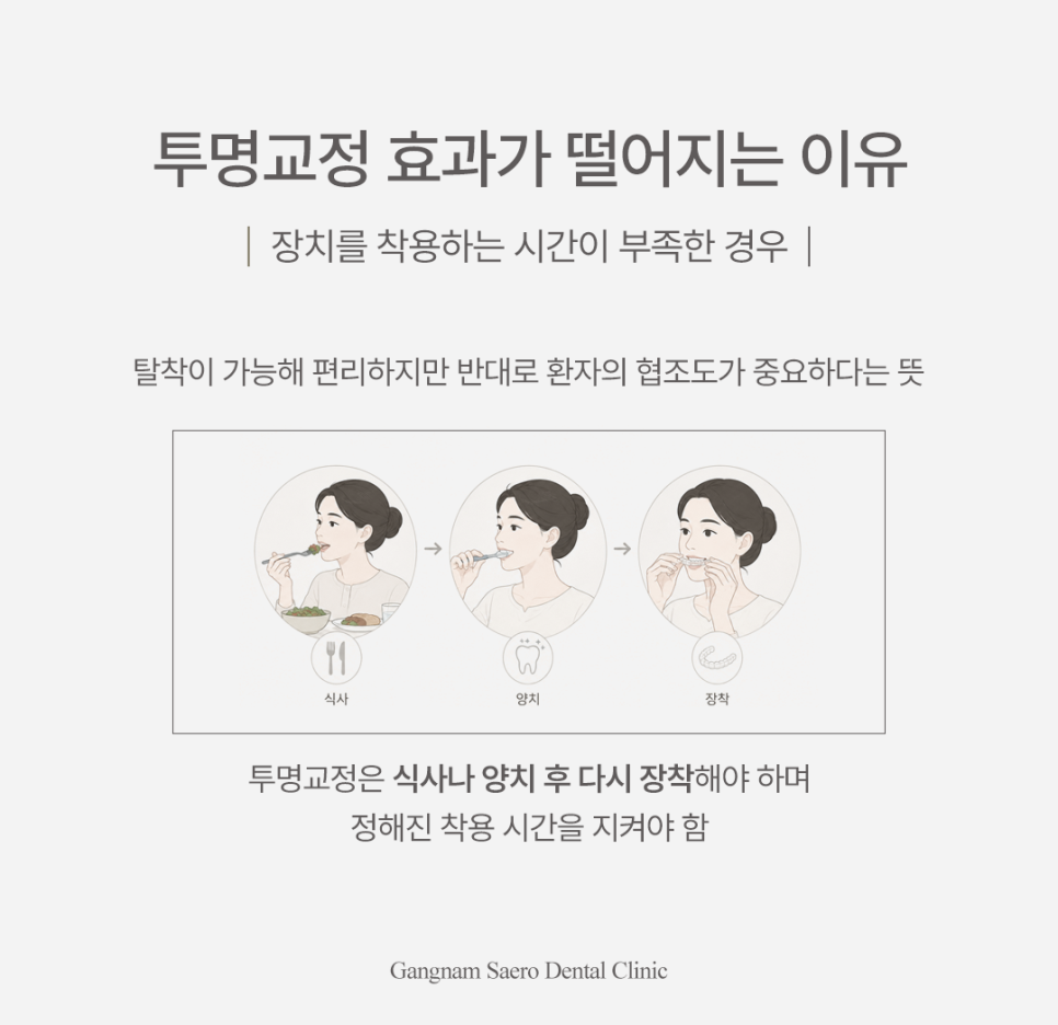 투명교정후회 안 하려면, 투명교정 시작 전 반드시 알아야 할 효과 회귀 재발 관련 이미지 3