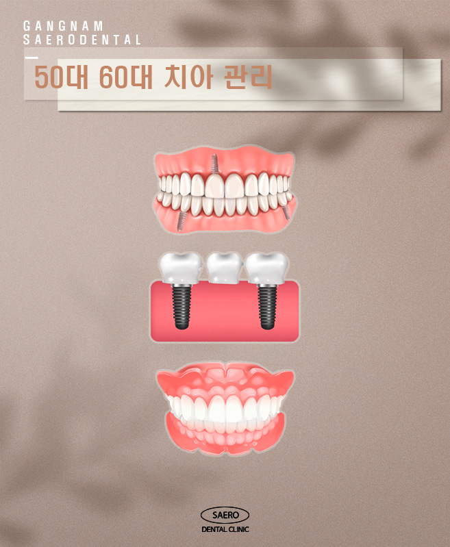 연령별 치아 관리 (임플란트 브릿지 틀니 비교) 관련 이미지 6