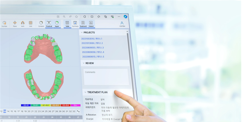 투명교정종류 자세히 알아보기 (3) 매직얼라인 관련 이미지 3