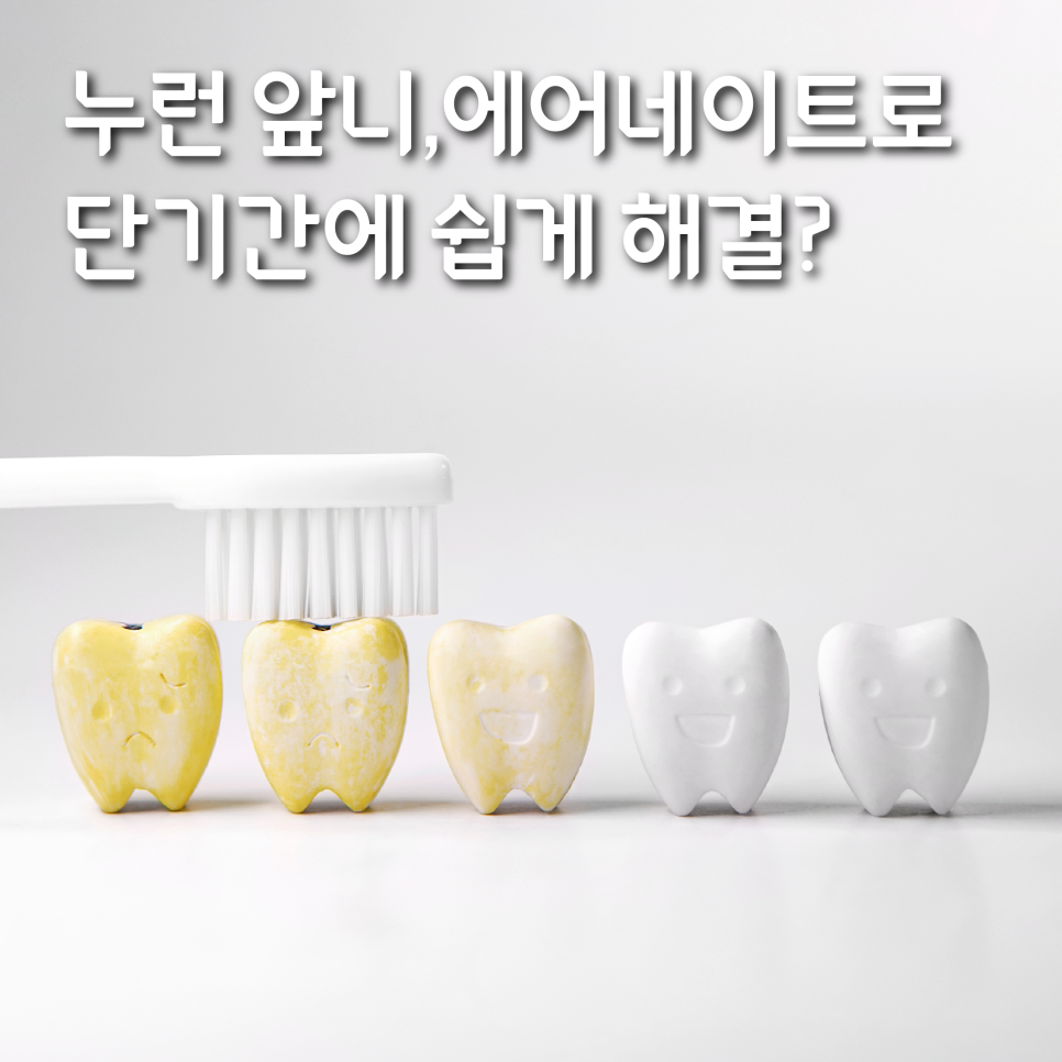 누런 앞니, 치아의 문제를 에어네이트 진료로 해결하려면 관련 이미지 1