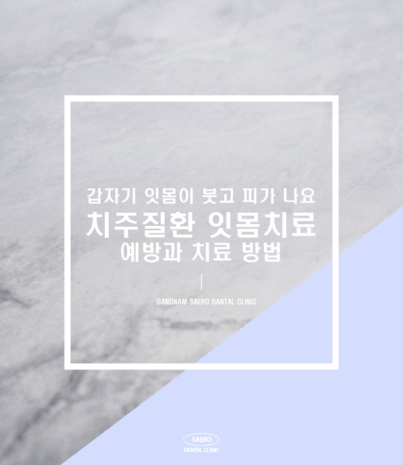 갑자기 잇몸 부을 때 정확한 원인과 올바른 해결 방법 (잇몸부음이유) 관련 이미지 1