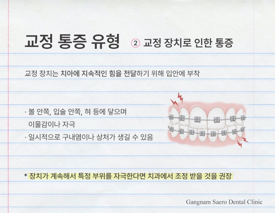 치아교정 많이 아픈가요? 통증 이유와 줄이는 방법 (치아교정통증) 관련 이미지 5