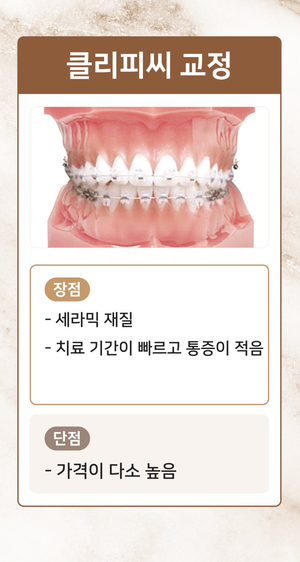 강남새로치과 치아교정종류 통해 맞춤형 교정 진료 (치아교정종류) 관련 이미지 4