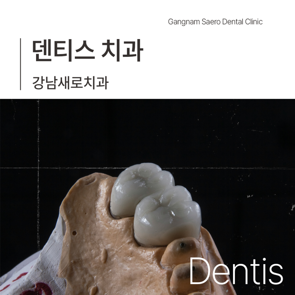 덴티스란 무엇인가요? (임플란트회사 덴티스) 관련 이미지 5