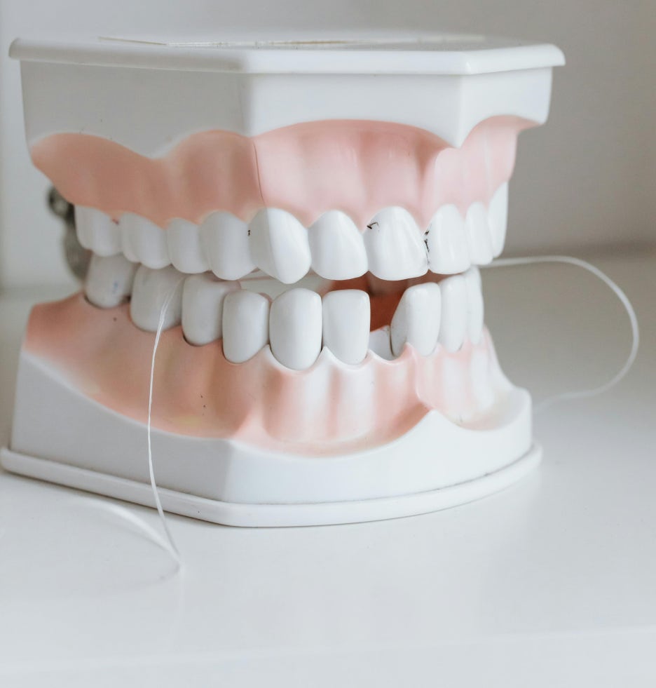 치아 미백 종류와 원인에 따른 치료 방법 알아봐요 관련 이미지 2