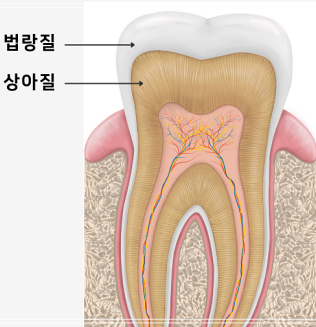헨리라미네이트, 치아 손상없이 안전하게 진행 관련 이미지 4