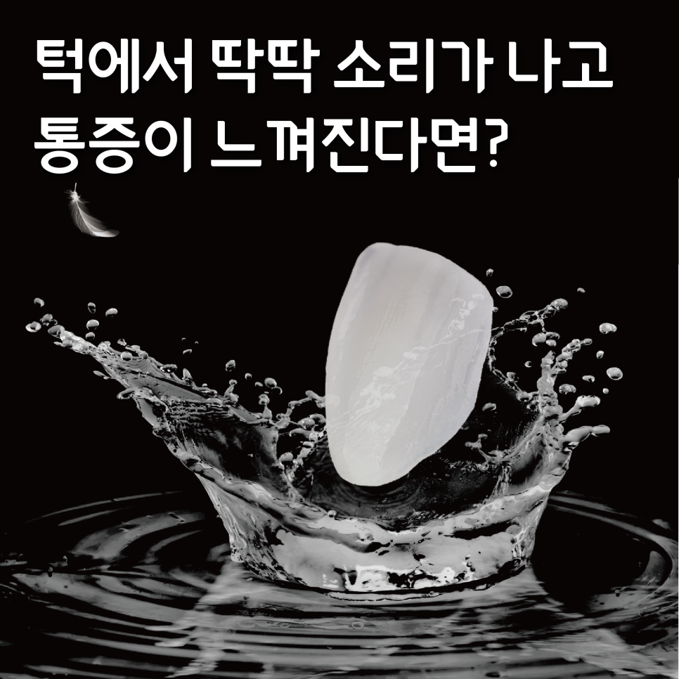 헨리라미네이트, 보다 안전한 진행 과정의 에어네이트로 관련 이미지 3