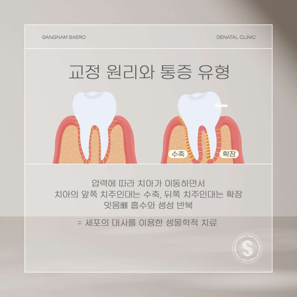 치아 교정 아픈가요? (교정통증) 관련 이미지 3