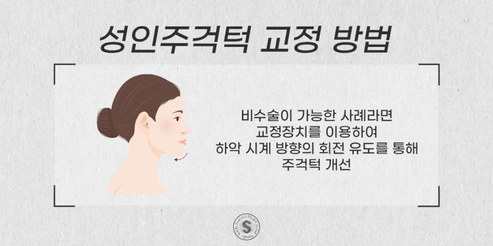성인주걱턱 지금이라도 치료하려면 (성인비수술주걱턱) 관련 이미지 3