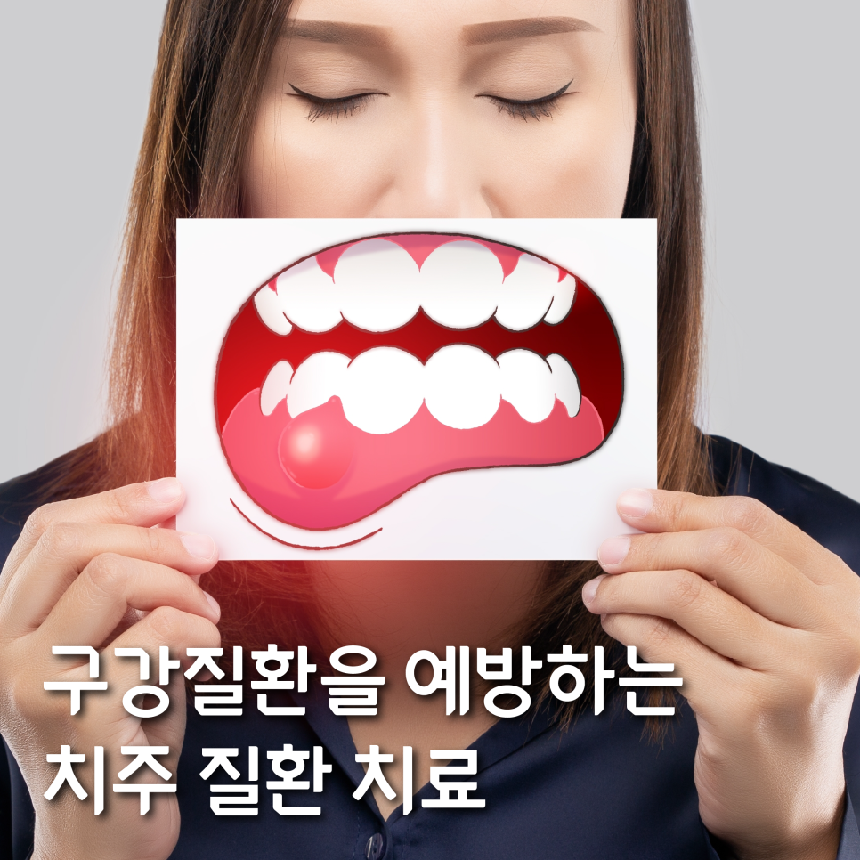 구강질환을 예방하는 치주질환치료 관련 이미지 4