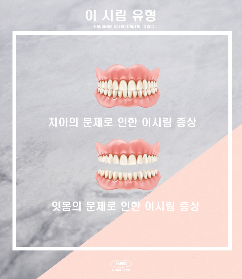 갑자기 이가 시려요 해결 방법 (이시림원인) 관련 이미지 2