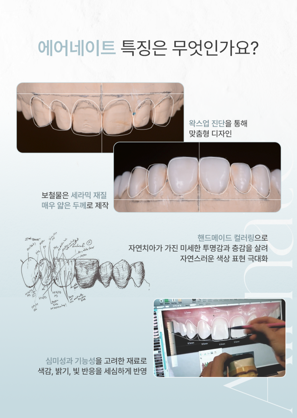 빠르게 달라지는 미소 부담은 줄인 치아성형 (삭제 제로라미네이트) 관련 이미지 4