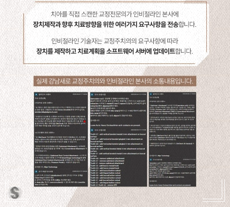 벌어진 앞니 교정, 단기간 치료로 해결? 관련 이미지 9