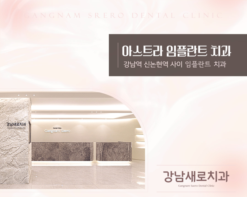 임플란트종류 자세히 알아보기 (1) 임플란트회사 아스트라 관련 이미지 4