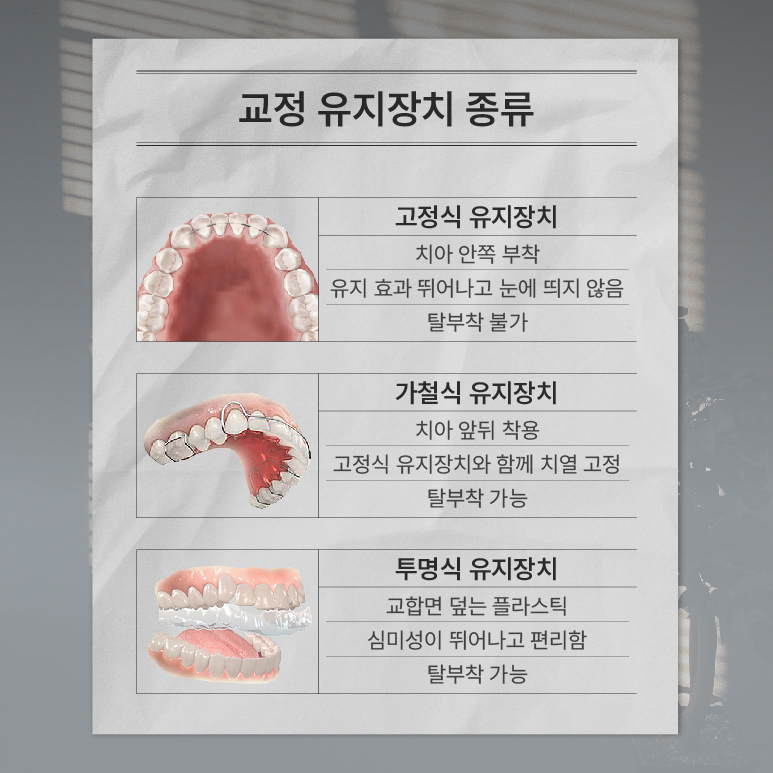 치아교정 종료 후 교정유지기 꼭 해야 하나요? (교정유지기) 관련 이미지 4