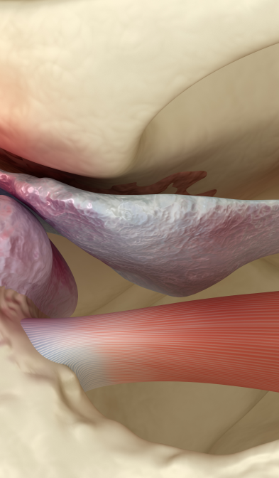 턱관절 탈구가 발생하는 원인과 치료 방법? 관련 이미지 6