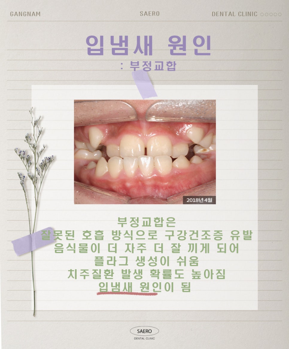 양치질을 해도 입냄새가 난다면 (구취 원인과 해결법) 관련 이미지 8