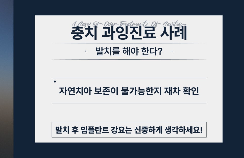 양심치과가 말해주는 충치치료 비양심치과 알아보는 법 [ 강남새로치과 ] 관련 이미지 4