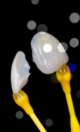 기안라미네이트 치아 손상 걱정없이 보다 안전한 진행 방법? 관련 이미지 11