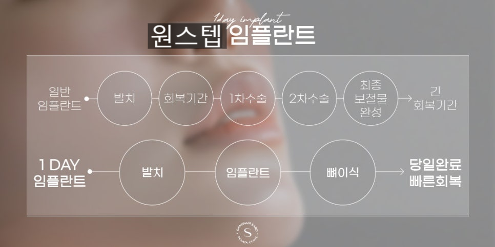 최대 6개월 단축 가능한 2030 임플란트 (원스텝임플란트) 관련 이미지 2