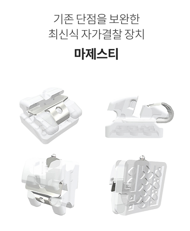 강남새로치과 자가 결찰 교정 오스템교정 (마제스티 트리니티 LPA) 관련 이미지 2