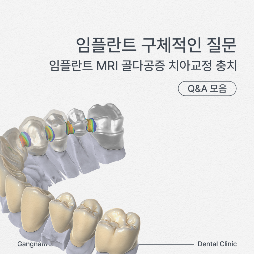임플란트 구체적인 질문 MRI, 골다공증, 치아교정, 충치 Q&A 모음 관련 이미지 1