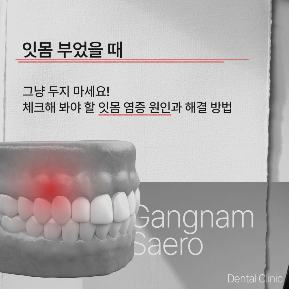 (잇몸부었을때) 그냥 두지 마세요! 체크해 봐야 할 사항들! 관련 이미지 1