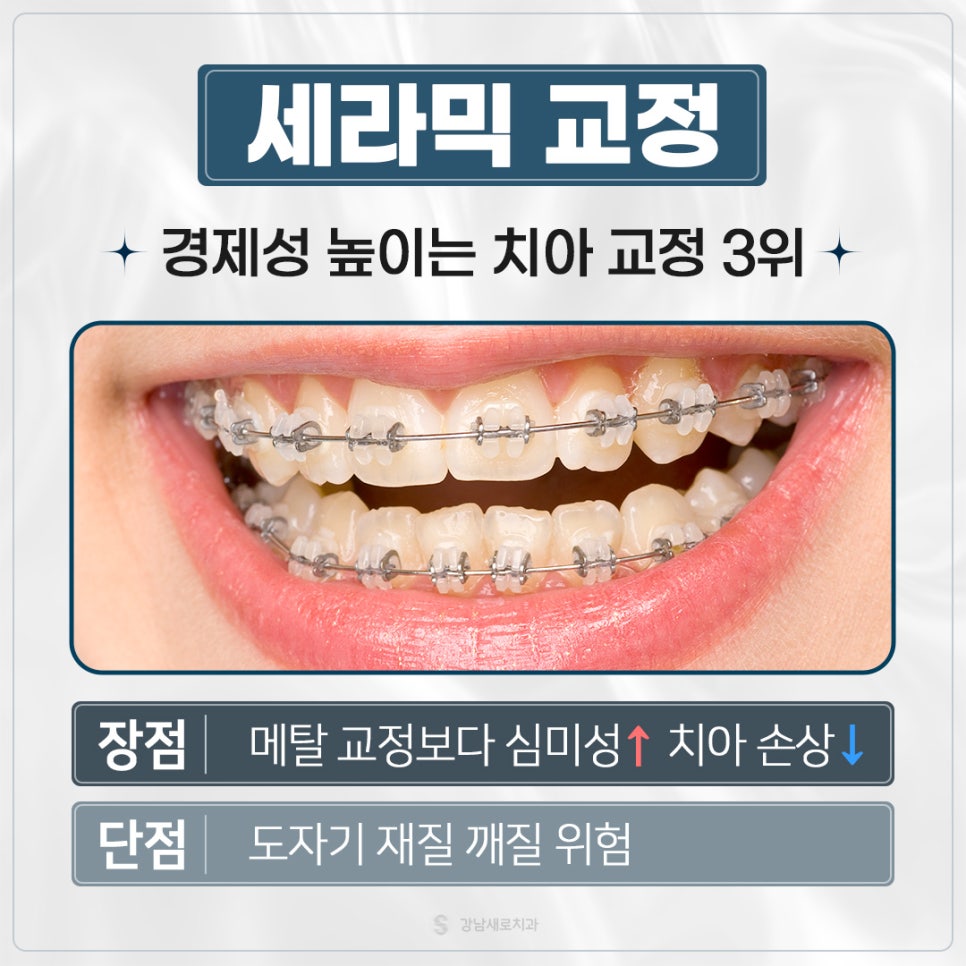 치아교정가격 교정비용비교 교정비용정리 (치아교정비용) 관련 이미지 4