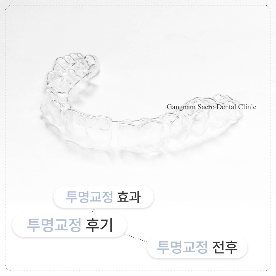투명교정효과 투명교정후기 투명교정전후 관련 이미지 1