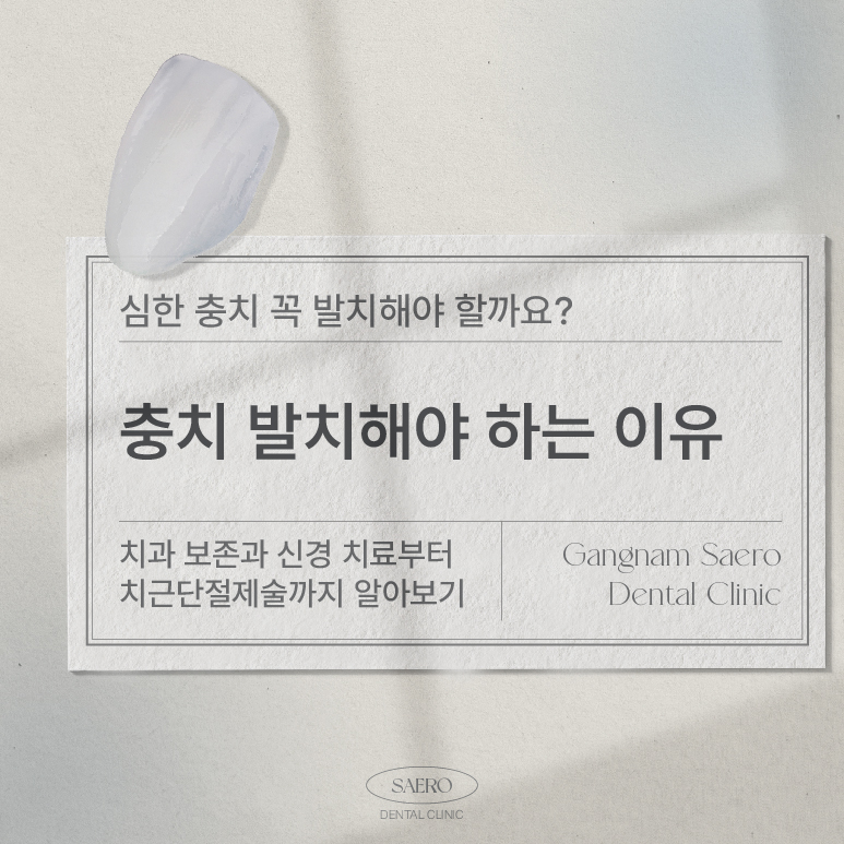 발치 전 최후의 수단 자연치아보존 (치근단절제술) 관련 이미지 1