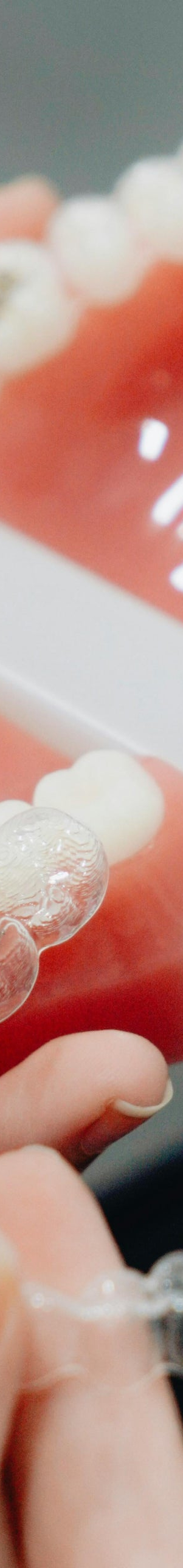 치아 교정이 궁금해? 치료가 좋은 결과로 이어지려면 관련 이미지 10