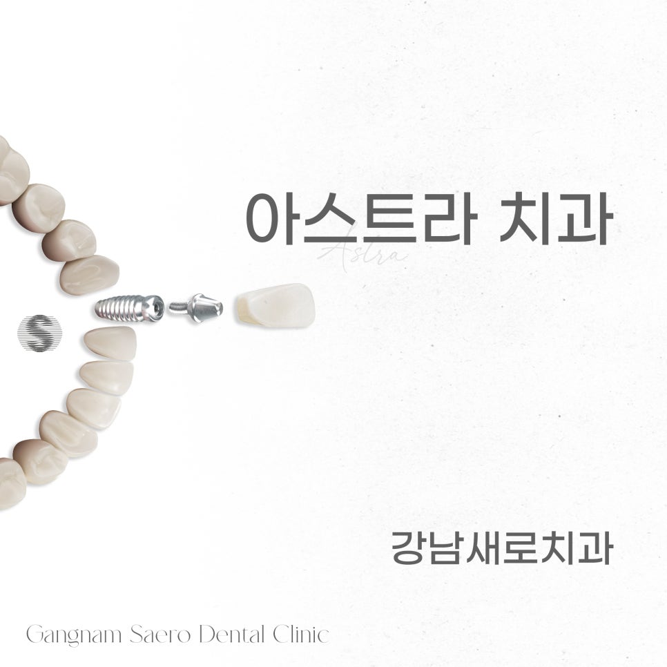 임플란트회사 임플란트종류 임플란트브랜드 (1) 아스트라 관련 이미지 4