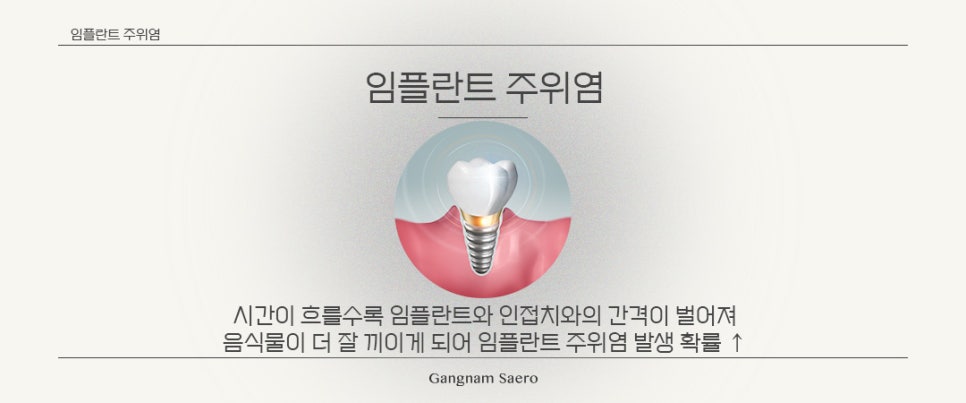 임플란트 수술 후 주의사항 (임플란트사후 임플란트관리) 관련 이미지 2