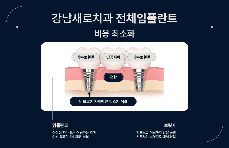 임플란트에 공경심을 담아봅니다 (건강보험임플란트) 관련 이미지 3